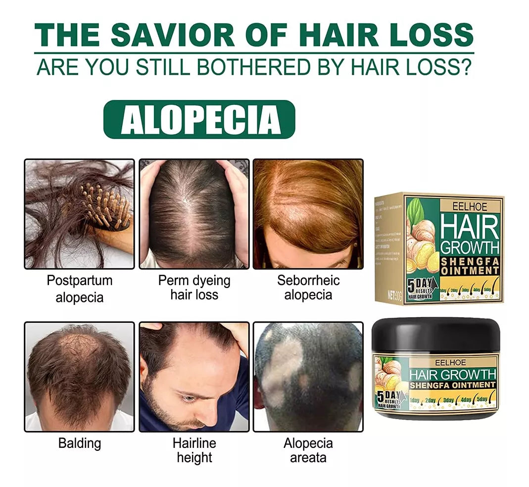 EELHOE™ | Aumento del cabello con jengibre.