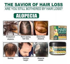 EELHOE™ | Aumento del cabello con jengibre.