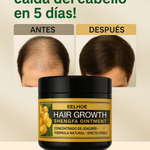 EELHOE™ | Aumento del cabello con jengibre.