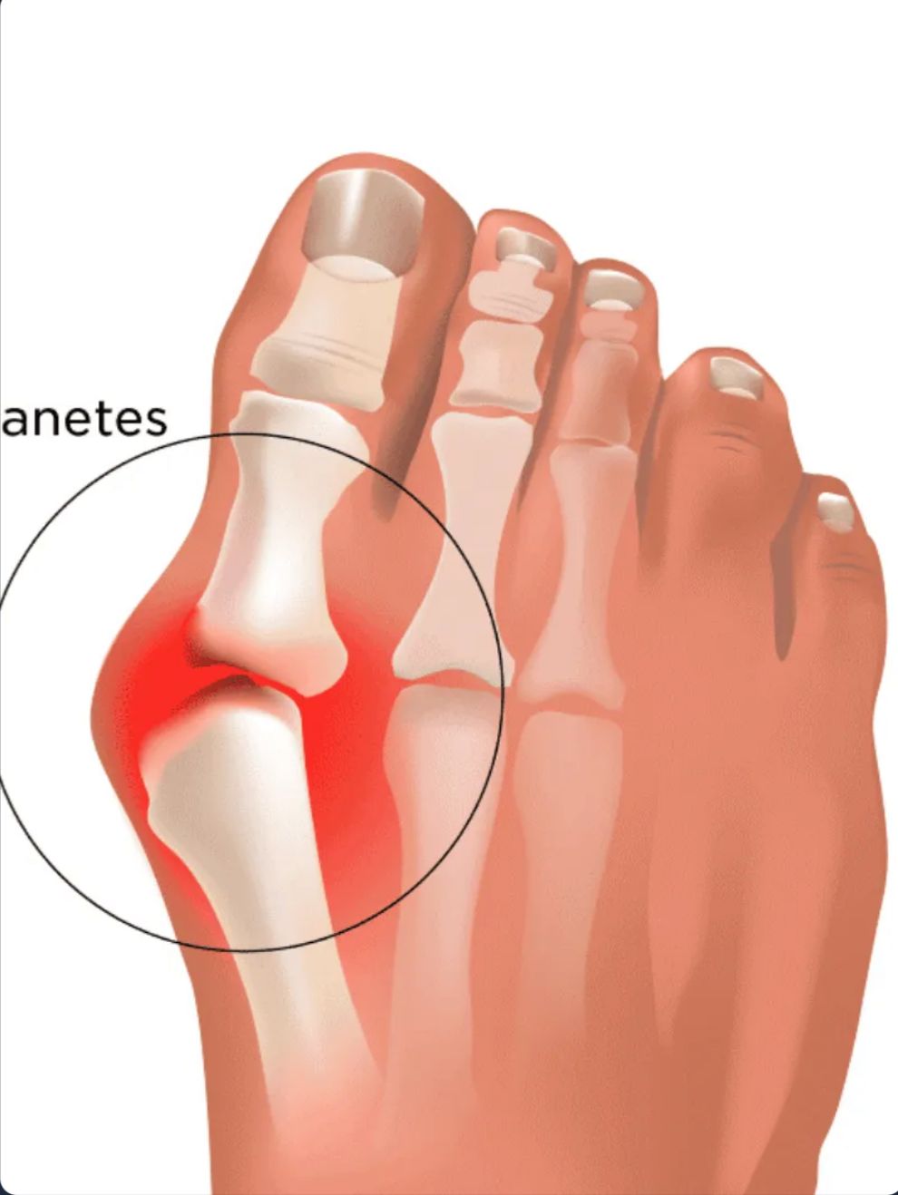 ArthroCare Pro™ X2 UNIDADES! | Bienestar articular comprobado