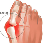 ArthroCare Pro™ X2 UNIDADES! | Bienestar articular comprobado