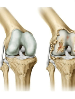 ArthroCare Pro™ X2 UNIDADES! | Bienestar articular comprobado